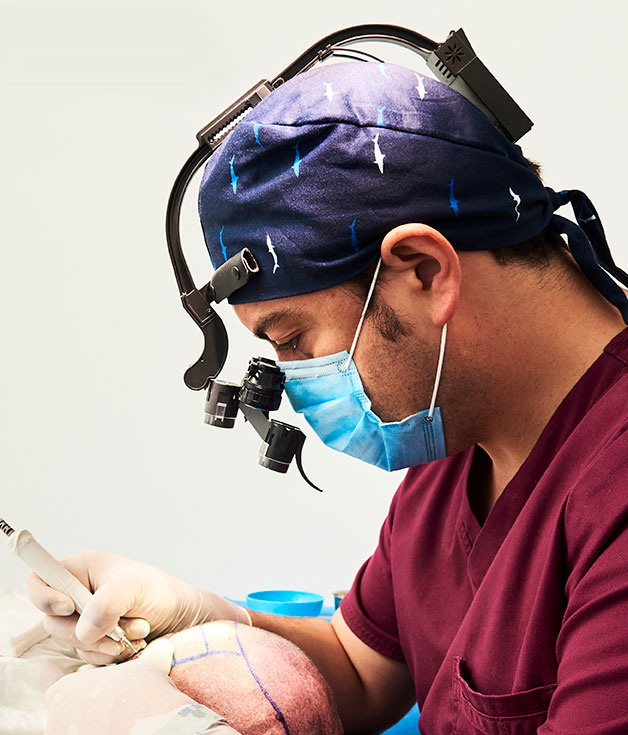 Cirurgià Capil·lar Andorra Cirurgià Capil·lar Andorra